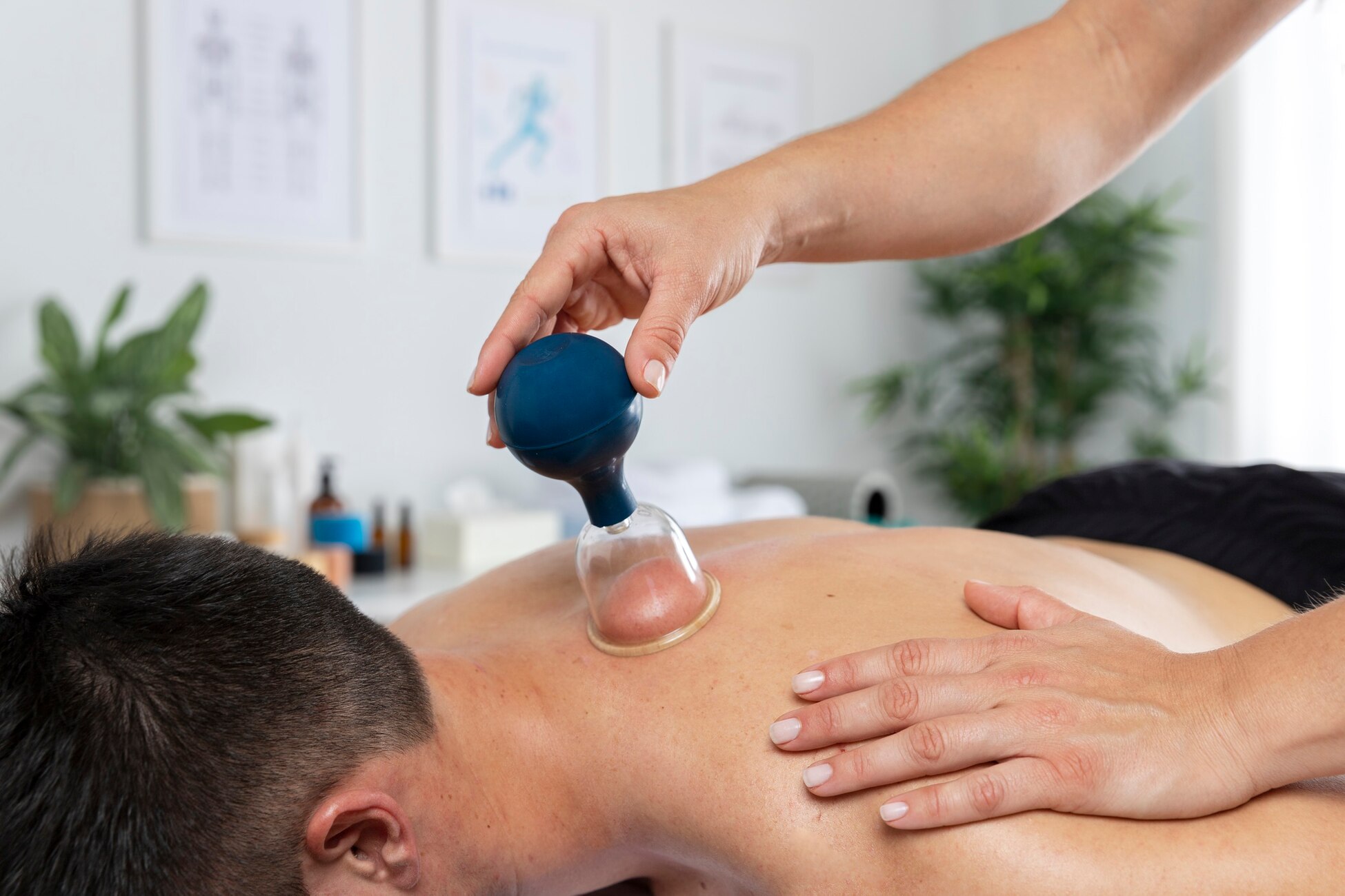 Natural Pain Relief with Cupping Therapy